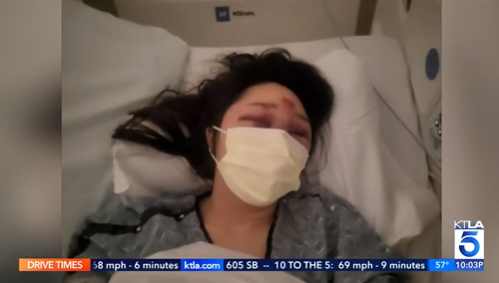 洛杉矶Costco停车场遭袭女子发声 警方追捕两名嫌疑人