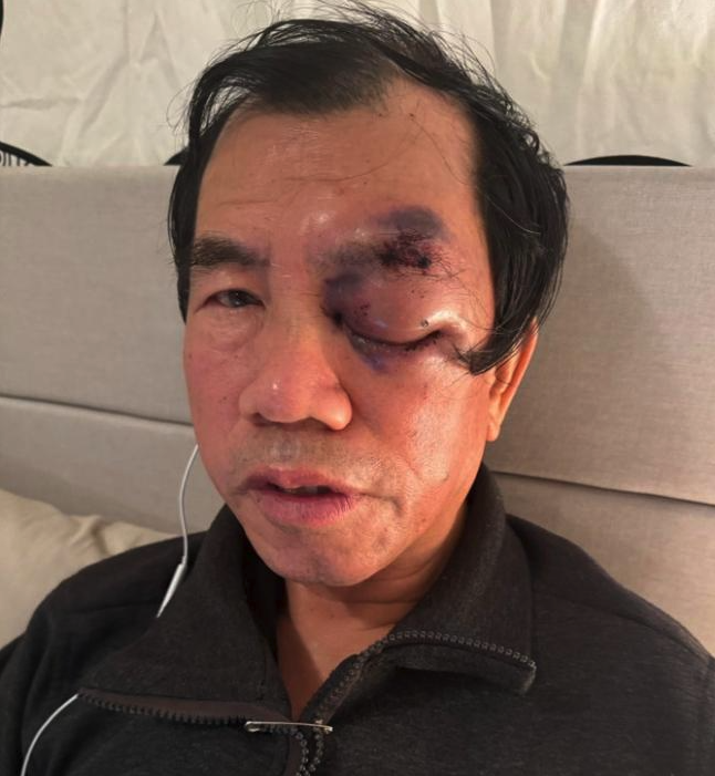 73岁华裔钓鱼遭白人暴力袭击 指认可能为种族歧视