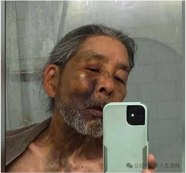 讽刺！美国71岁教授讲了一辈子“种族歧视”，却被暴力撞伤怒骂：滚回你的国家！
