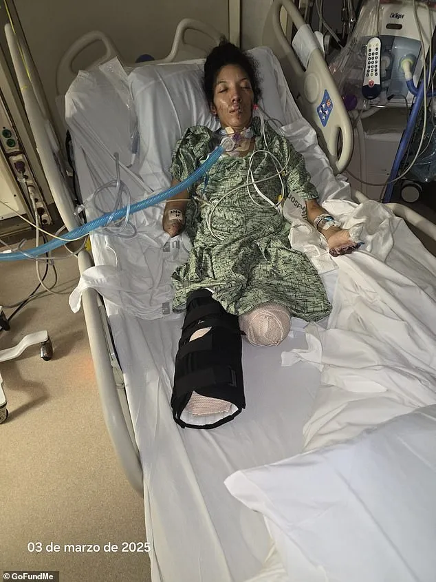 警惕! 普通感冒竟导致截肢 39岁美国妈妈一夜间四肢坏死 症状恐怖!