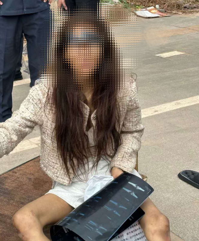 闽籍女在海外街头流浪！面容憔悴腿部骨折 网友发视频找人 领事馆一查：是她……