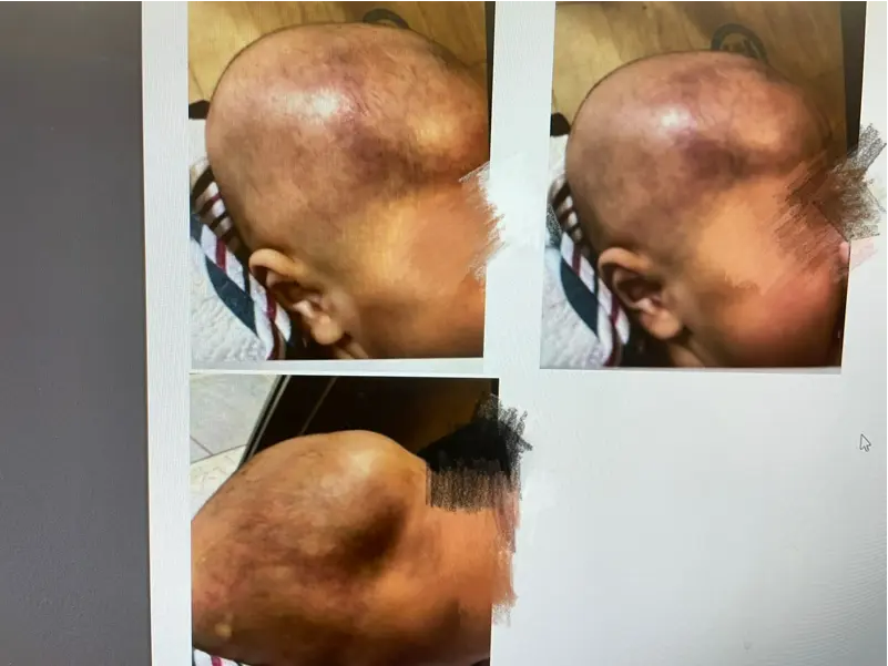 触目惊心！照片曝光：南加豪宅21名幼童遭虐待，2月龄男婴颅脑重伤！
